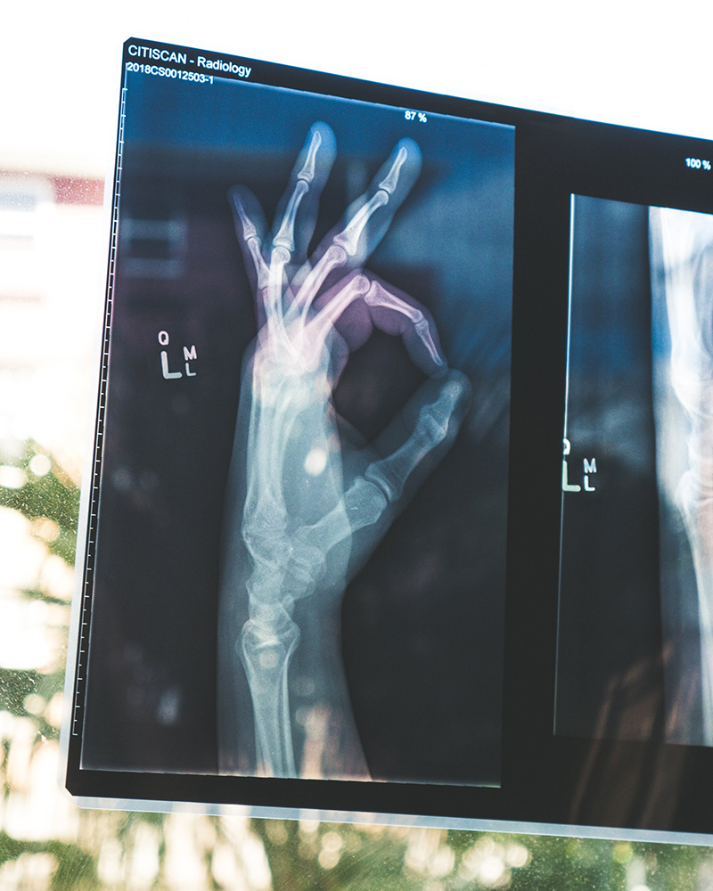 A hand x-ray holding up an okay symbol